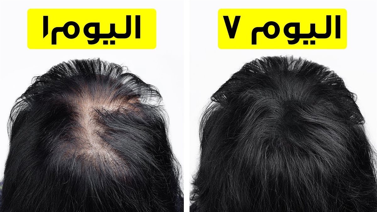 وصفات لتكثيف الشعر الخفيف بسرعة