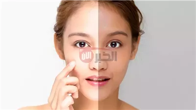 ودعي التصبغات مع أفضل طريقة تفتيح البشرة السمراء مجربة وآمنة 100%