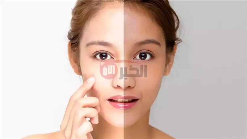 طريقة تفتيح البشرة