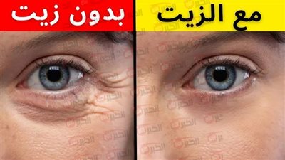 أفضل الزيوت الطبيعية لترطيب الجسم  ومنح بشرتك النعومة والإشراق